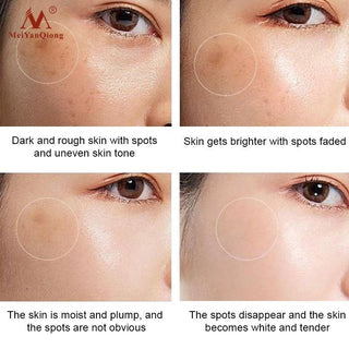 Dark Spot Remover Cream Skin Lightening Cream Dark Skin Care Anti Freckle  Whitening Cream  Anti Aging Face Care Alodia Store