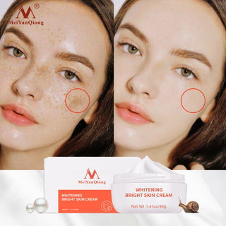 Dark Spot Remover Cream Skin Lightening Cream Dark Skin Care Anti Freckle  Whitening Cream  Anti Aging Face Care Alodia Store