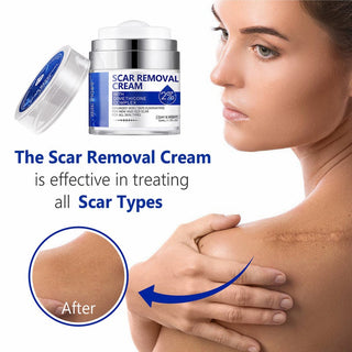 50ml Collagen Vitaming C Anti-aging Cream Retinol Face Cream Hyaluronic Acid Hydrating Vitamin E Tighten Skin Whitening Cream Alodia Store