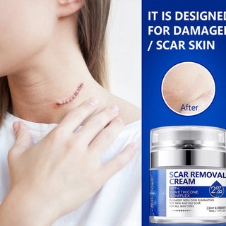 50ml Collagen Vitaming C Anti-aging Cream Retinol Face Cream Hyaluronic Acid Hydrating Vitamin E Tighten Skin Whitening Cream Alodia Store