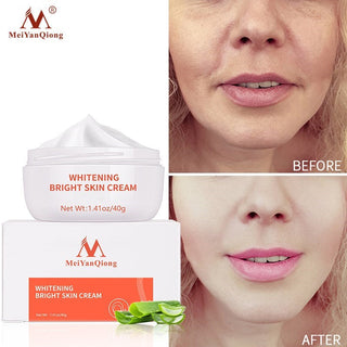 Dark Spot Remover Cream Skin Lightening Cream Dark Skin Care Anti Freckle  Whitening Cream  Anti Aging Face Care Alodia Store