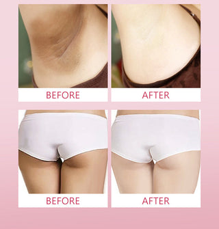 Whitening Cream Armpit Intimate Areas Brightening Underarm Private Parts Body Skin Care Whiten Cream For Dark Skin Beauty Health Alodia Store