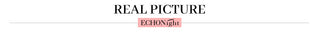 Echonight Transparent Lingerie Bandage Hollow Out Women's Underwear Set Sexy Female Bra and Party Set Erotic Lingerie Wholesale ALODIA STORE