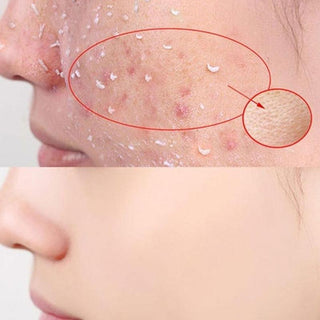 100ml Papaya Exfoliating Cream Scrub Peeling Gel Face Cream Face Body Skin Whitening Care Body Moisturizing Hand ALODIA STORE