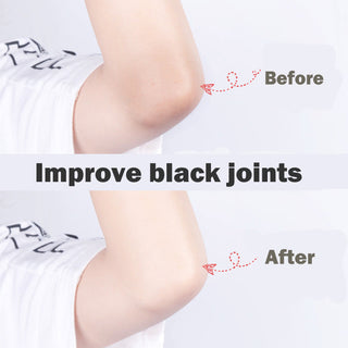 Niacinamide Whitening Body Scrub Cream Moisturizing Skin Exfoliating for Whole Body Pimple Removal Whitening Joints Bath Using ALODIA STORE