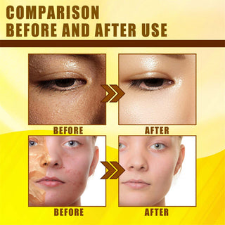 30ml Exfoliating Yellow Skin Oil Bleaching Dark Skin Removing Arms Knees Melanin Moisturizing Skin Whitening Beauty Skin Care ALODIA STORE