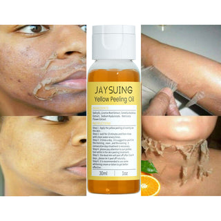 30ml Exfoliating Yellow Skin Oil Bleaching Dark Skin Removing Arms Knees Melanin Moisturizing Skin Whitening Beauty Skin Care ALODIA STORE