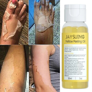 Exfoliation Yellow Peeling Oil Foot Leg Remove Dead Skin Deep Cleansing Remove Dark Whitening Body Skin Care ALODIA STORE