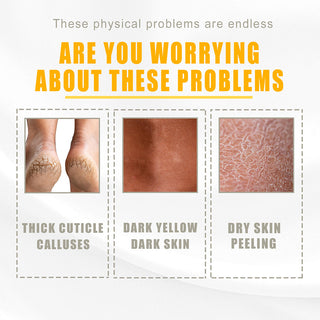 30ml Yellow Peeling Oil Lighten Dark Spots Acne Melanin Skin Bleaching Exfoliating Oil Whiten Brighten Skin For Face Body ALODIA STORE