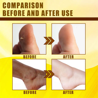 30ml Exfoliating Yellow Skin Oil Bleaching Dark Skin Removing Arms Knees Melanin Moisturizing Skin Whitening Beauty Skin Care ALODIA STORE