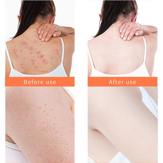 150g Turmeric Scrubs Body Face Nourish Moisturizing Exfoliating Hand Deep Cleansing Acne Scarring Psoriasis Dead Skin Remove ALODIA STORE