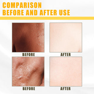 30ml Yellow Peeling Oil Lighten Dark Spots Acne Melanin Skin Bleaching Exfoliating Oil Whiten Brighten Skin For Face Body ALODIA STORE