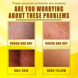 30ml Exfoliating Yellow Skin Oil Bleaching Dark Skin Removing Arms Knees Melanin Moisturizing Skin Whitening Beauty Skin Care ALODIA STORE