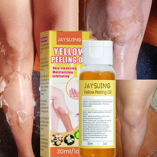 30ml Exfoliating Yellow Skin Oil Bleaching Dark Skin Removing Arms Knees Melanin Moisturizing Skin Whitening Beauty Skin Care ALODIA STORE
