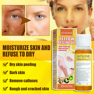 30ml Exfoliating Yellow Skin Oil Bleaching Dark Skin Removing Arms Knees Melanin Moisturizing Skin Whitening Beauty Skin Care ALODIA STORE