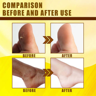 30ml Exfoliating Yellow Skin Oil Bleaching Dark Skin Removing Arms Knees Melanin Moisturizing Skin Whitening Beauty Skin Care ALODIA STORE